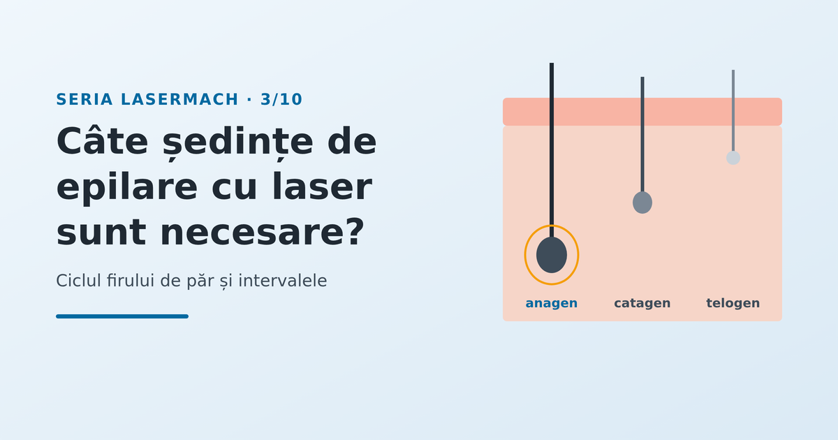 Câte ședințe de epilare cu laser sunt necesare și de ce - imagine reprezentativă