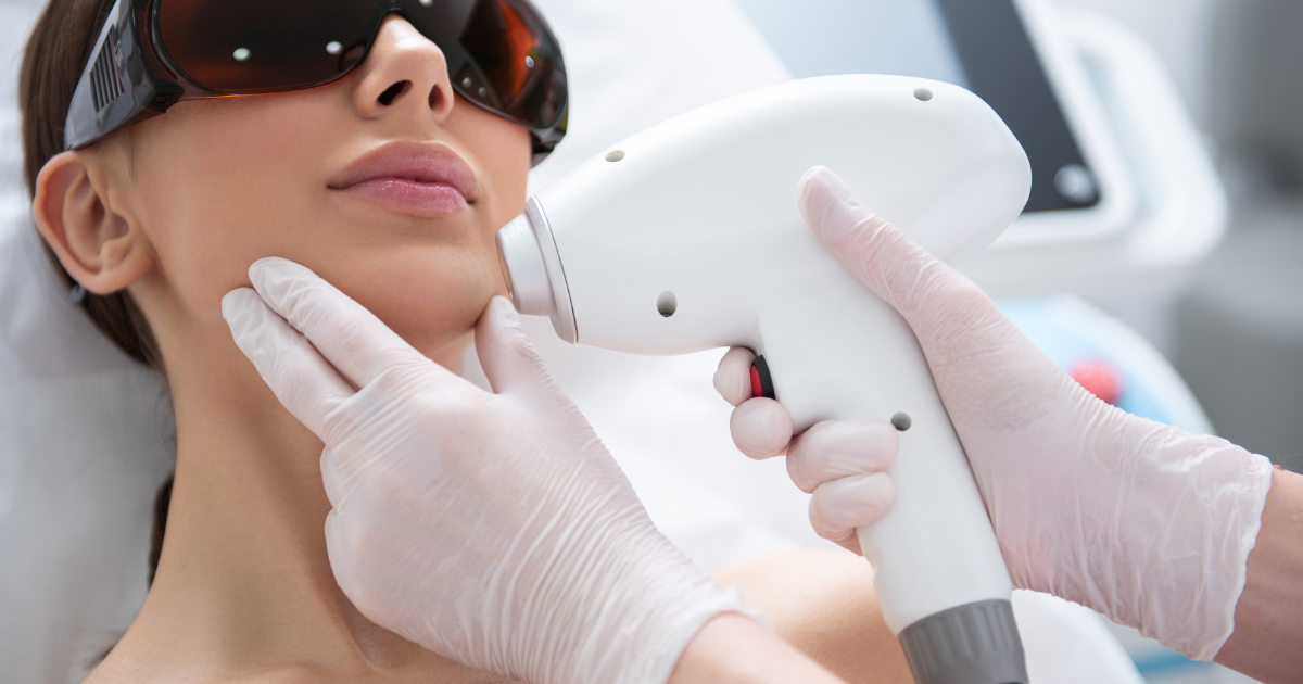 Cum să alegeți un laser pentru epilare definitivă - imagine reprezentativă