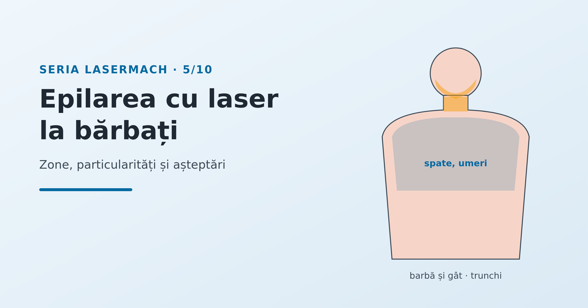 Epilarea cu laser la bărbați: zone, particularități și așteptări - imagine reprezentativă