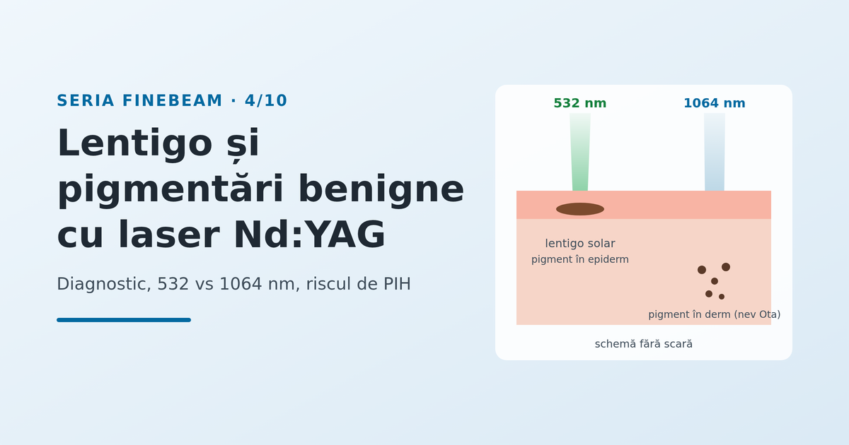 Lentigo și pigmentările benigne: ce poate face laserul Nd:YAG - imagine reprezentativă