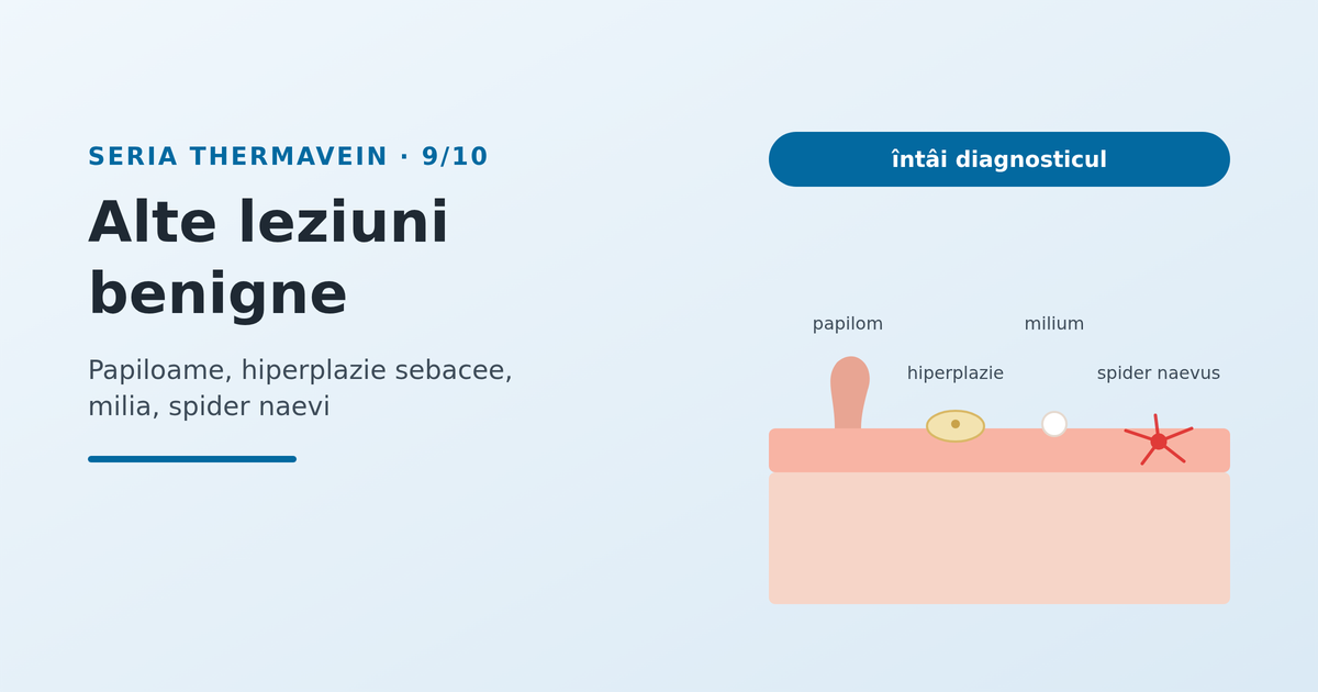 Alte leziuni benigne și termocoagularea: producătorul și studiile - imagine reprezentativă
