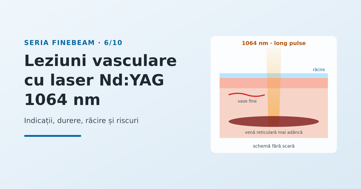 Leziunile vasculare cu laser Nd:YAG 1064 nm: indicații și precauții - imagine reprezentativă