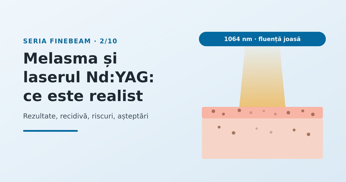 Melasma și laserul Nd:YAG: ce este realist - imagine reprezentativă