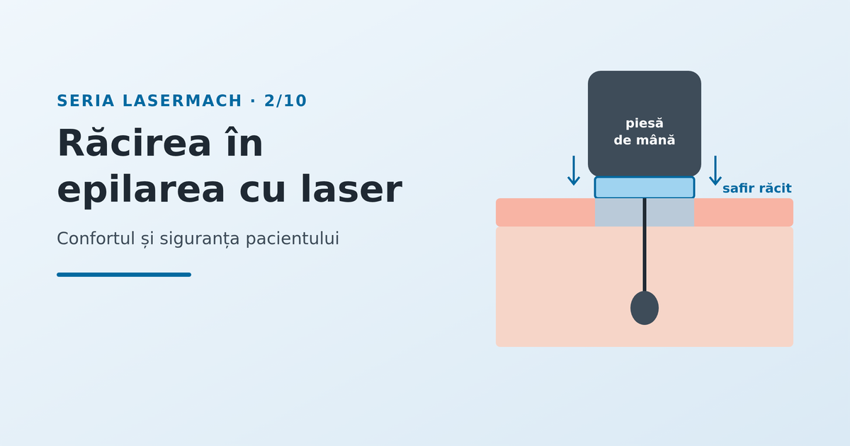 Răcirea în epilarea cu laser: confortul și siguranța pacientului - imagine reprezentativă