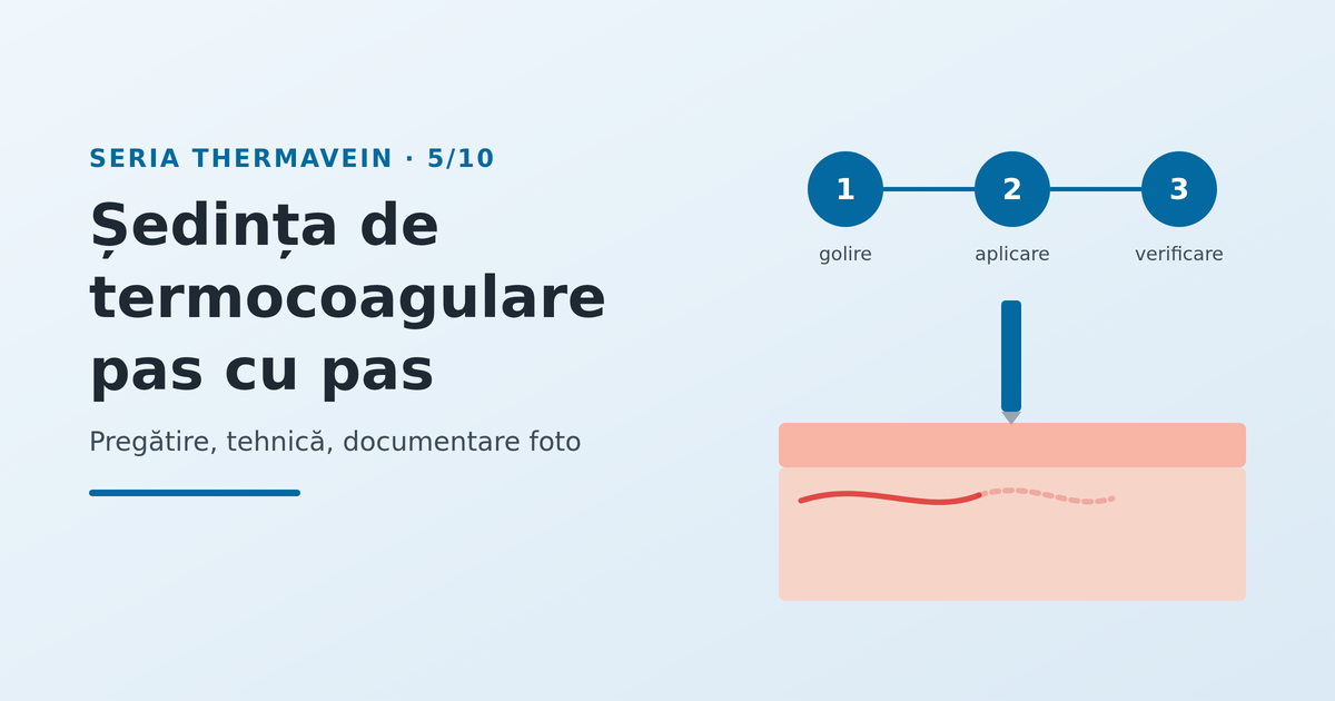 Ședința de termocoagulare pas cu pas - imagine reprezentativă