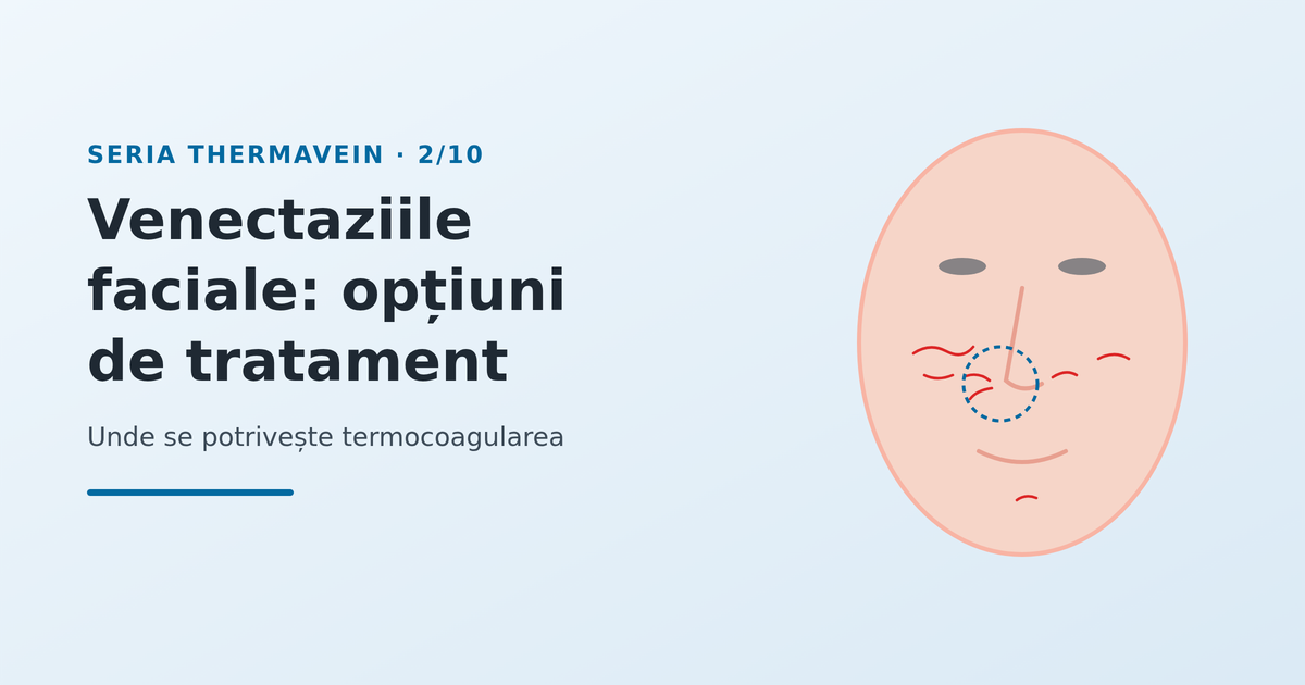 Venectaziile faciale: opțiuni de tratament și locul termocoagulării - imagine reprezentativă