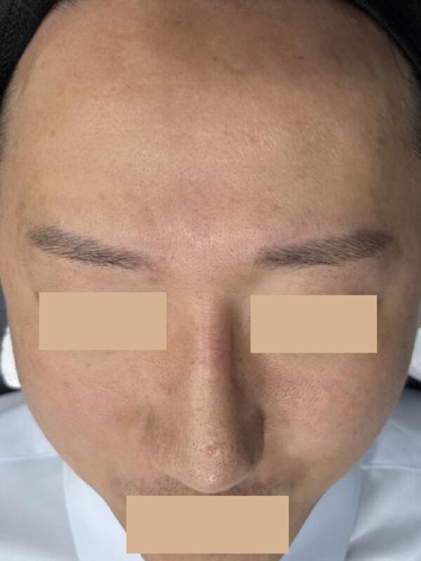 Fresh Peel, fermitate și ton, Înainte
